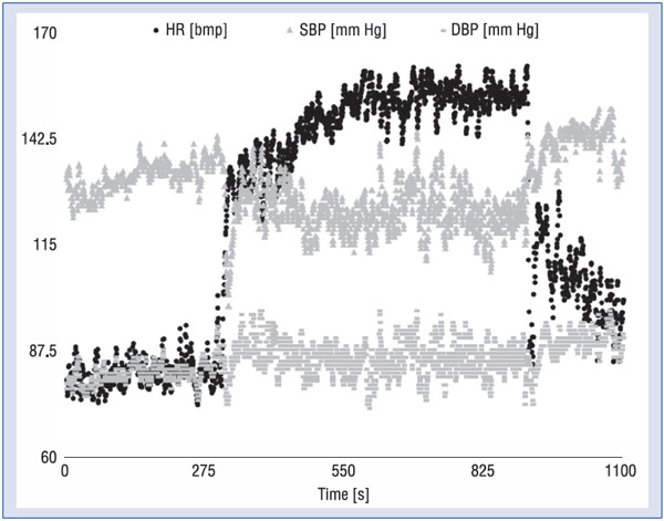 PDF) Randomized Trial of Ivabradine in Patients With Hyperadrenergic  Postural Orthostatic Tachycardia Syndrome