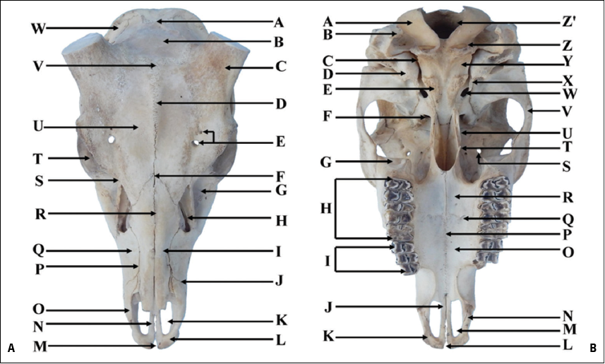 A Comparative Study On The Morphology Radiography And Computed