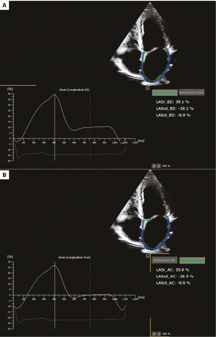 Left Atrial Strain  Circulation: Cardiovascular Imaging
