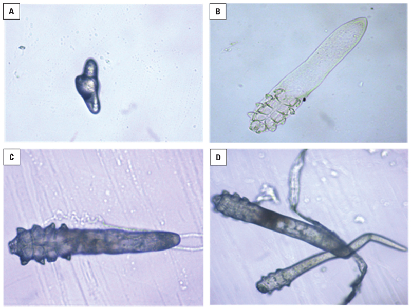 Blepharitis and Demodex spp. infection