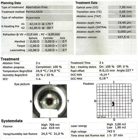 Kamra corneal inlay for the correction of presbyopia